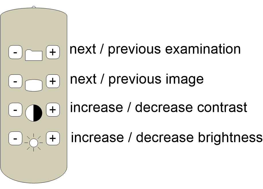 MISremoteControl.fullsize.gif
