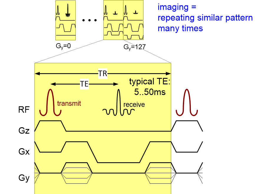MRimaging.fullsize.gif